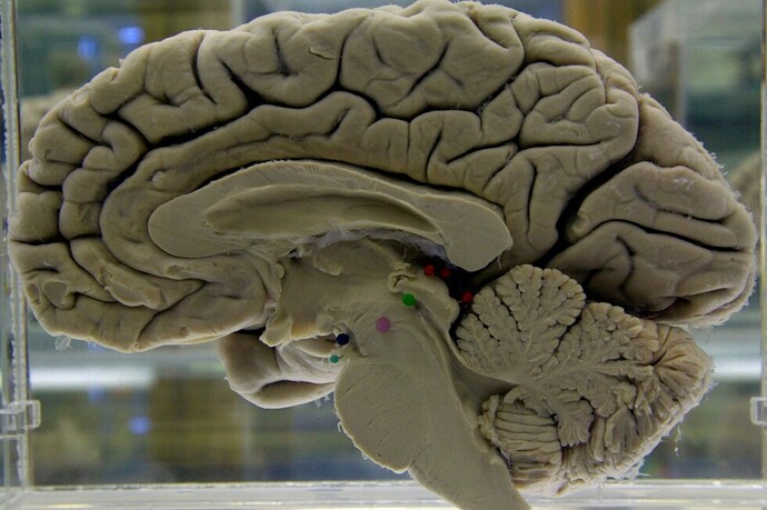 Challenging your brain helps keep it healthy. Here’s how to do it - AP News
